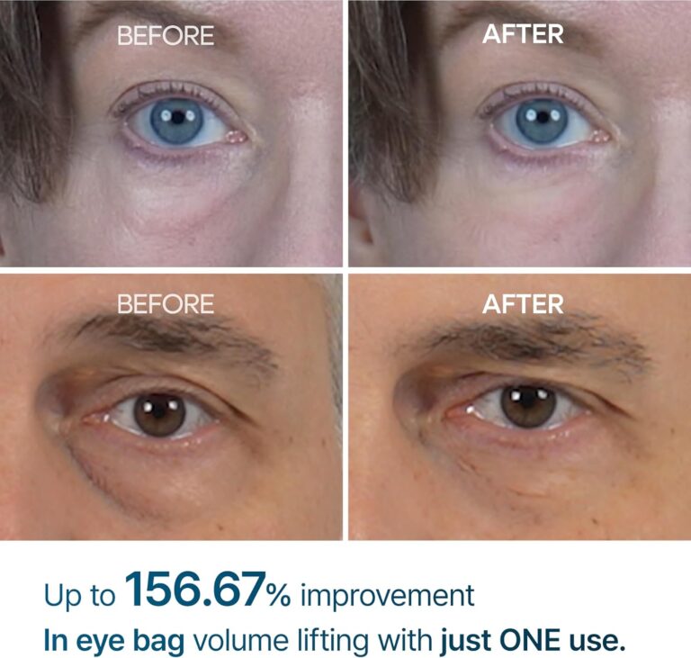Eye Care Treatments