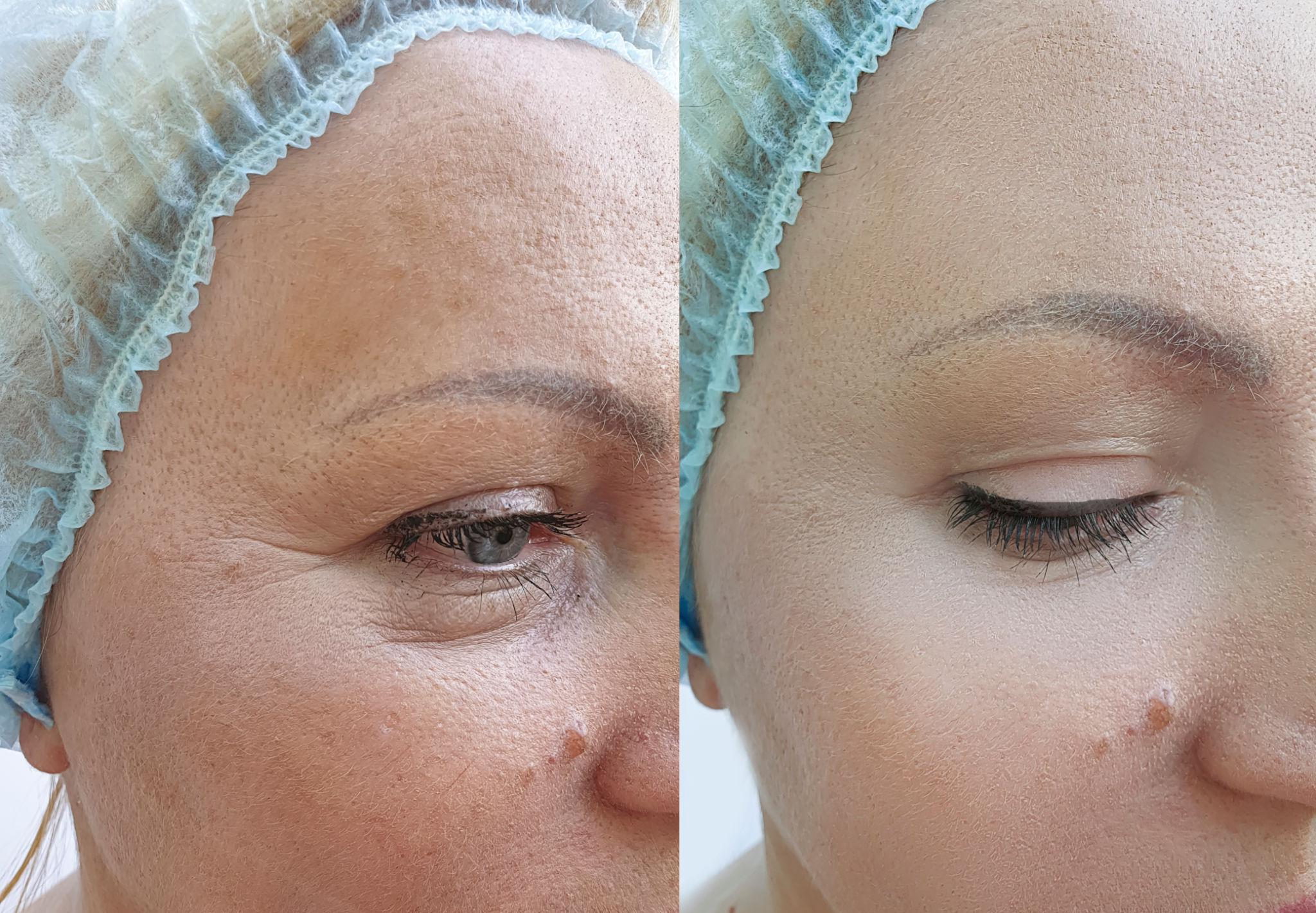 My skin texture feels cleaner and more even now. — Amélie, Quebec