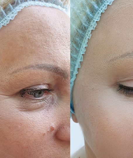 My skin texture feels cleaner and more even now. — Amélie, Quebec